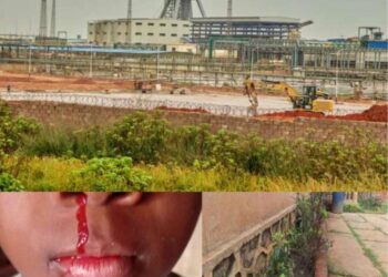 Lualaba : Ruashi Mining accusée de pollution, la population de Dilungu exposée aux graves risques sanitaires