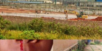 Lualaba : Ruashi Mining accusée de pollution, la population de Dilungu exposée aux graves risques sanitaires